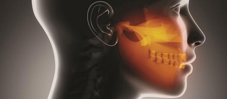 Dolore cronico e disordini temporo-mandibolari: nuove revisioni sistematiche svelano la neuropatofisiologia del problema Disordini temporo mandibolari: revisione sistematica