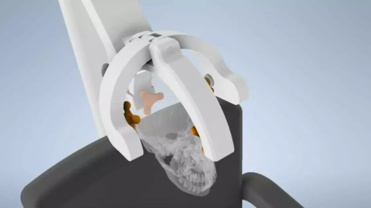“Cranial Device” è il brevetto dell’osteopata Michele Genga nei prossimi giorni a Rimini alla fiera internazionale WMF